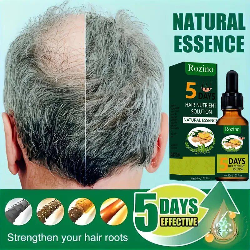 

Ginger Hair Care Essential Oil for Rapid Growth To Prevent Hair Loss Sparse Baldness Strong Hair Roots and Follicles