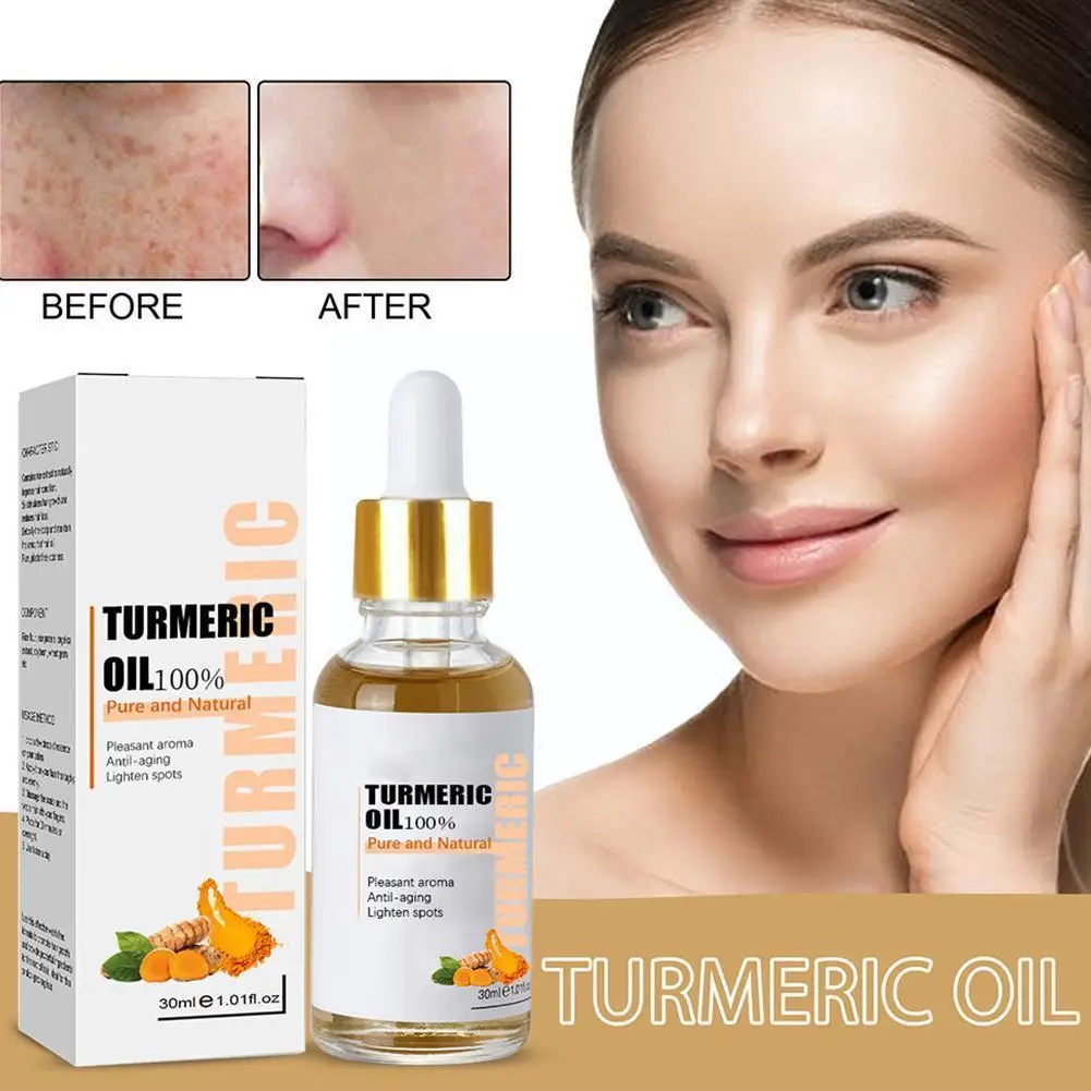 

Turmeric Freckle Whitening Serum Fade Dark Spot Removal Facial Face 30ml Correcting Pigment Essence Skin Beauty Car O7K5