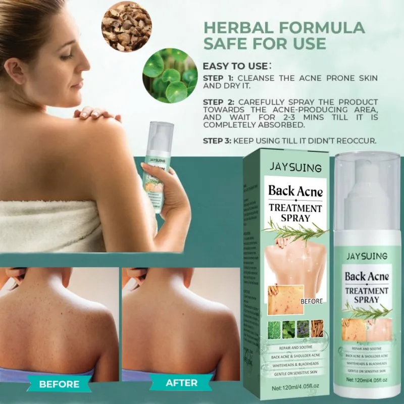 

Back Acne Treatment, Back Acne Spray, Salicylic Acid 2 Percent Spray, Body Acne Treatment with Herbal Formula Back Acne Solution