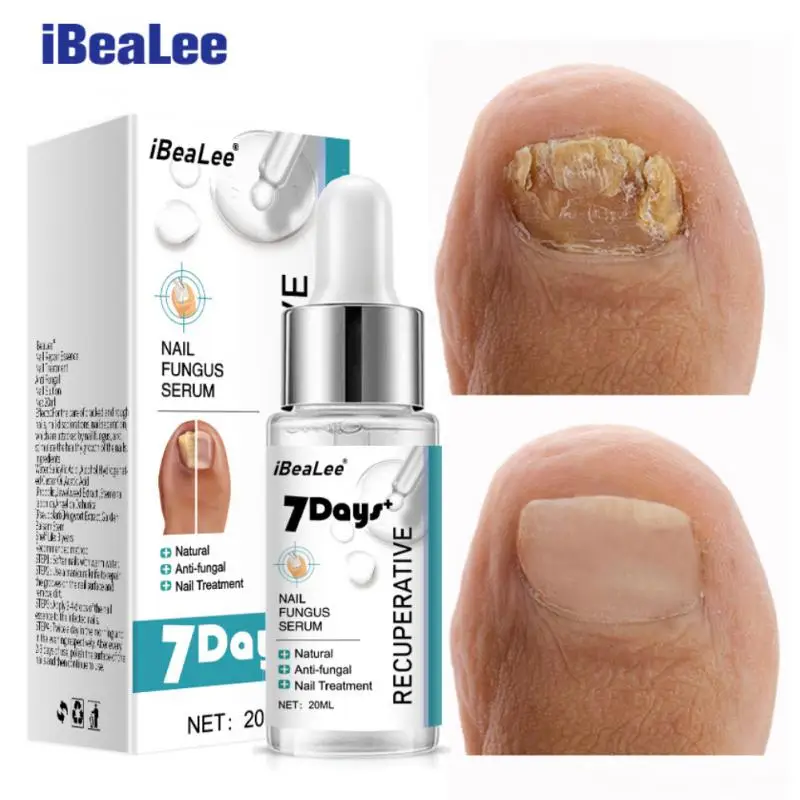 

IBeaLee 7 дней Лечение ногтей от грибка Сыворотка для восстановления ног онихомикоз против паронихии Уход за ногтями гель для удаления грибка