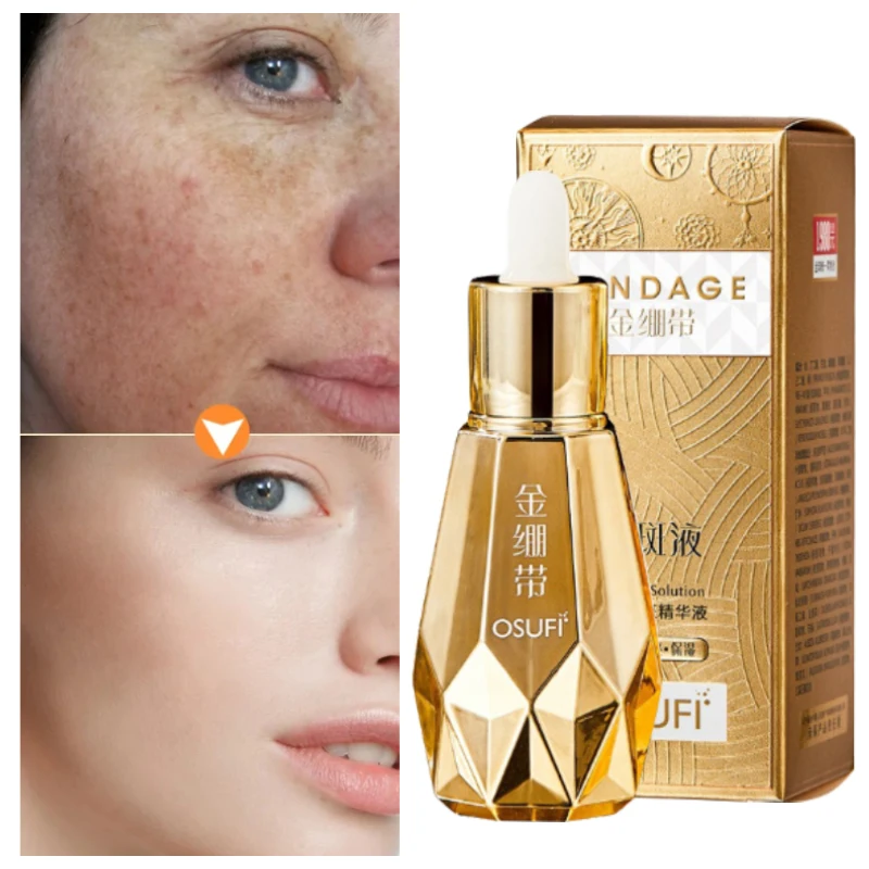 

Facial Black Spot Removal Serum Removing Sun Spots Melasma Lightening Pigmentation Moisturizing Brightening Skin Care 60ml