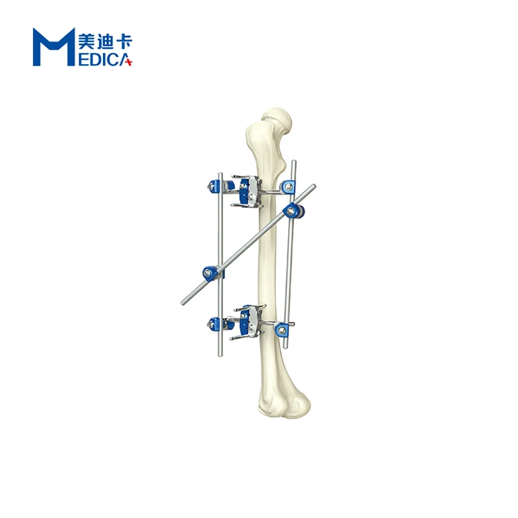 

Внешний фиксатор hoffman, ортопедические инструменты, Стрикер для радиуса, набор для хирургической фиксации, полукольцо