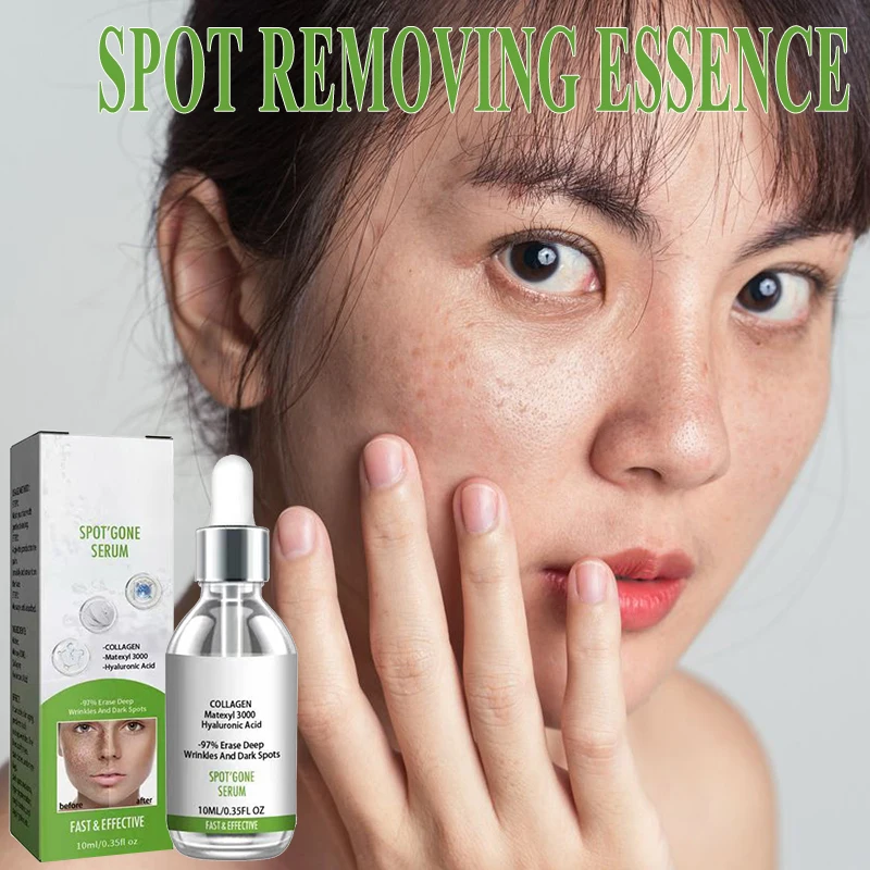

Anti Spot Remove Melasma Freckles Chloasma Dark Age Sun Ppots Hyperpigmentation Whitening Light Products