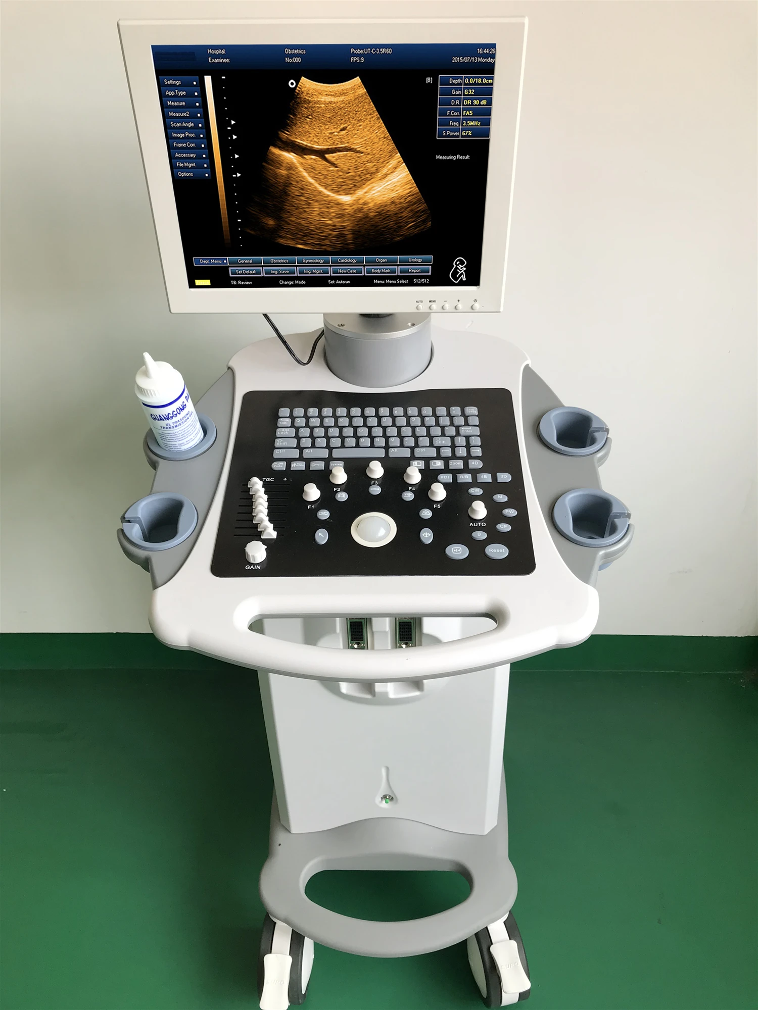 Trolley full digital 3D portable ultrasound