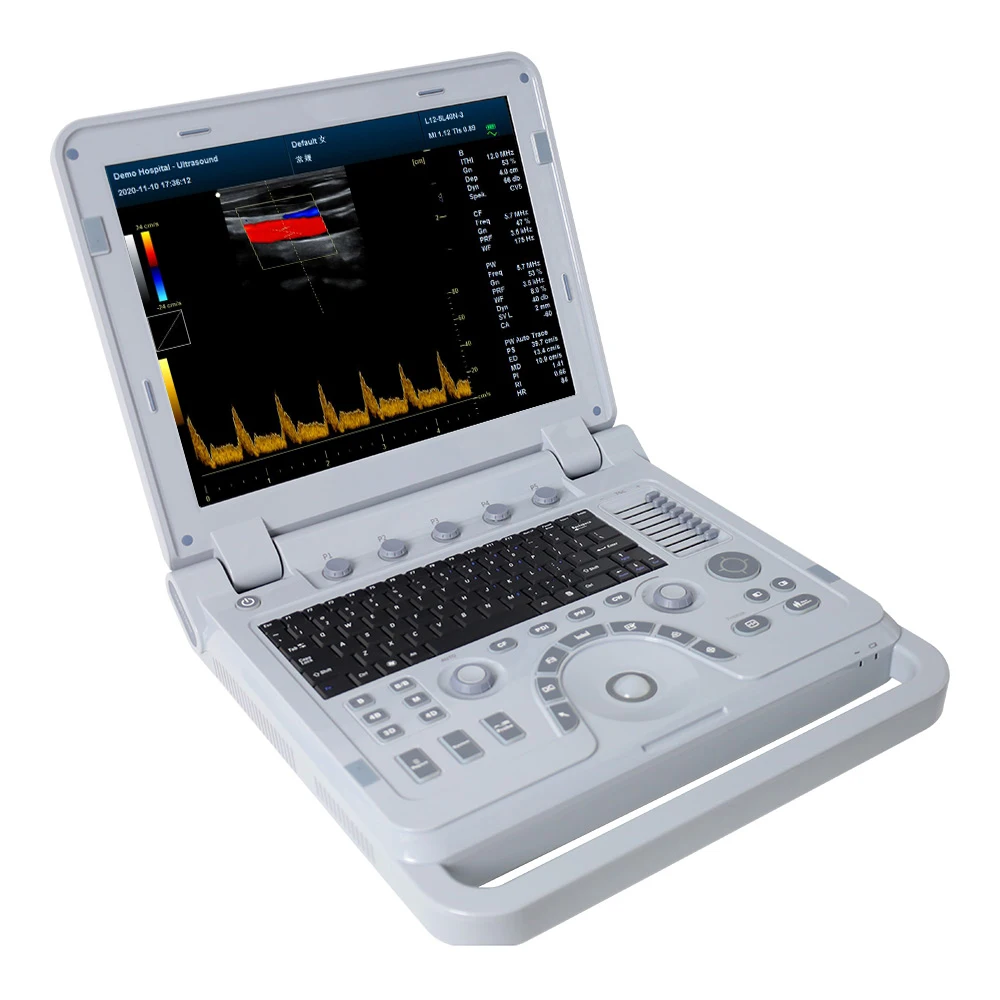 SupSep CONTEC CMS1700B Professional Diagnostic cardiology ultrasound cardiology color doppler