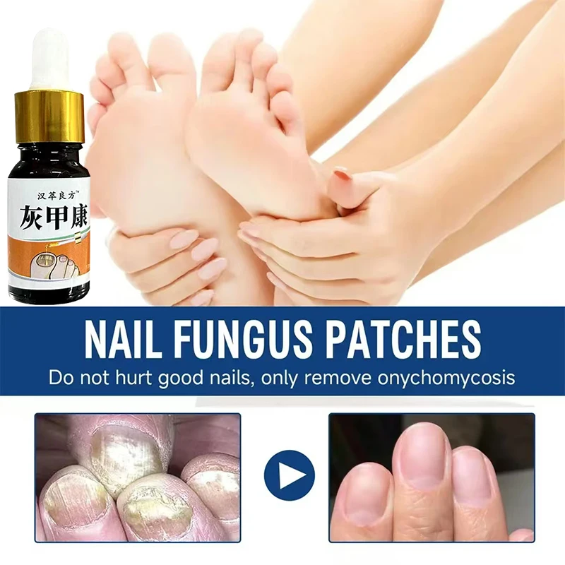 Solución mágica para a reparación de uñas 100% quattrotiva ingredientes prata puros