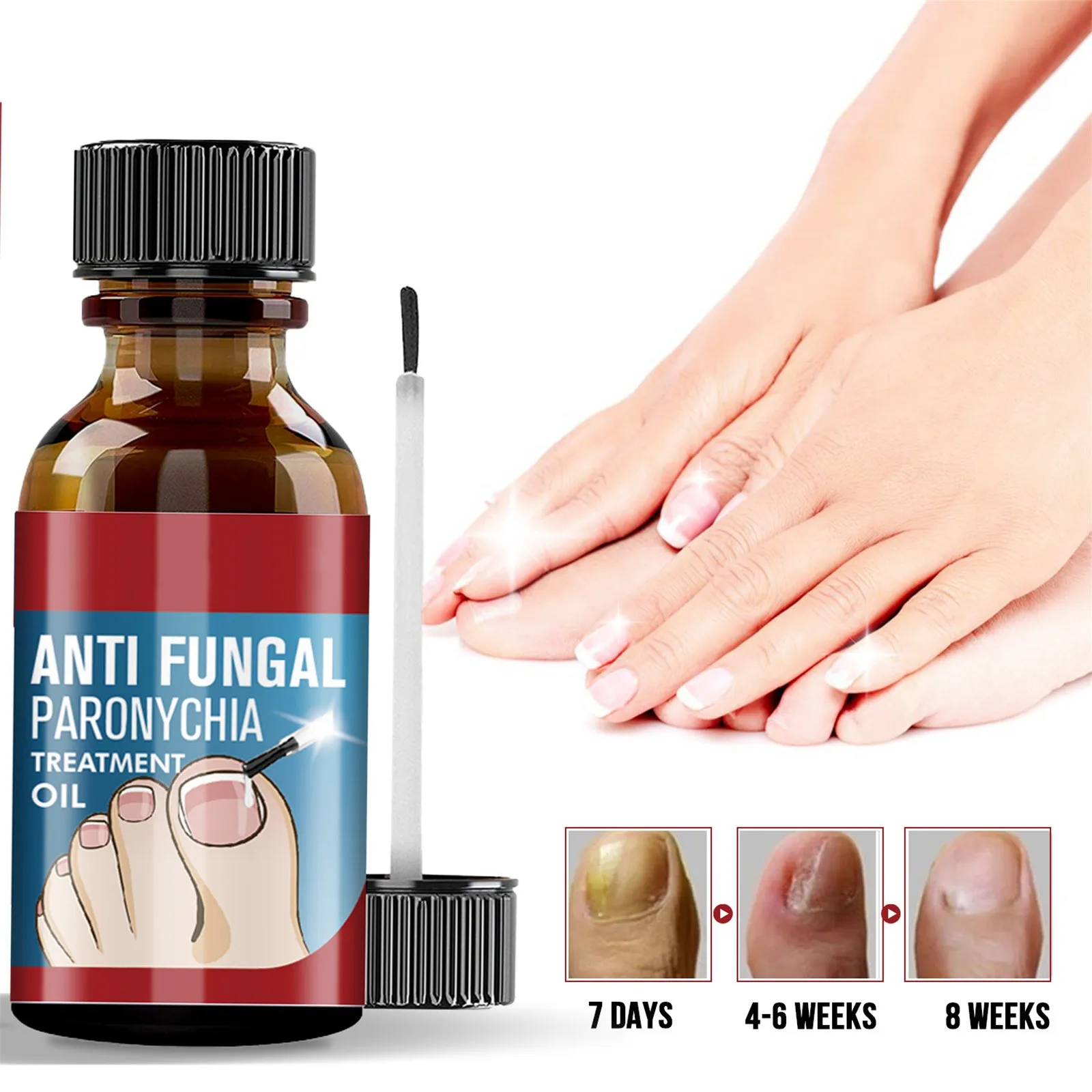 

Anti-Groove Relief Ingrown Fastacting Nail Care Liquid For Fungus Under & Around Restores The Healthy Appearance Of Nails