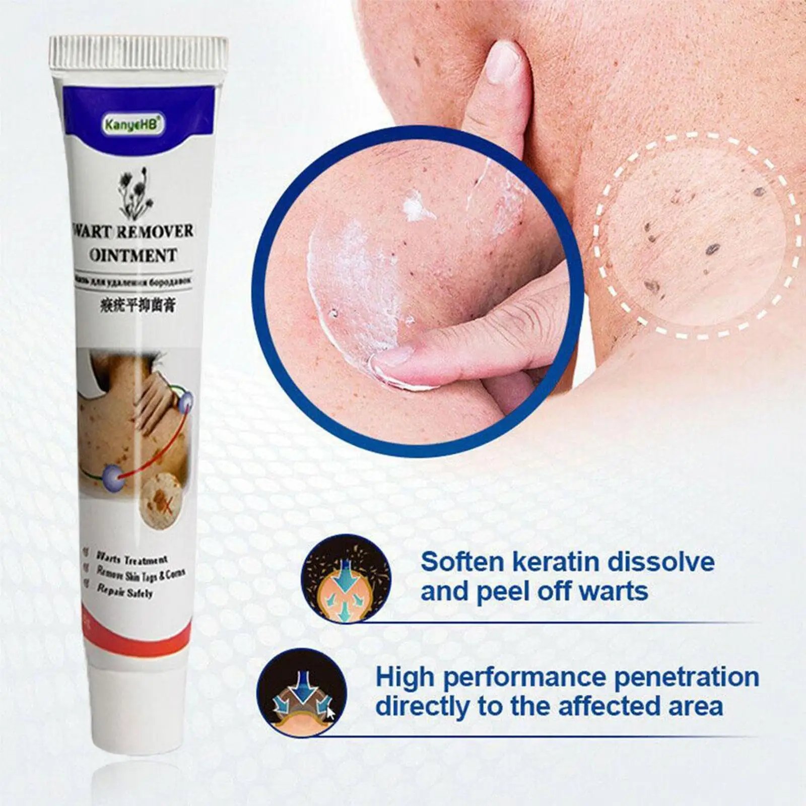 Рисунок 4 - Женская Антибактериальная мазь