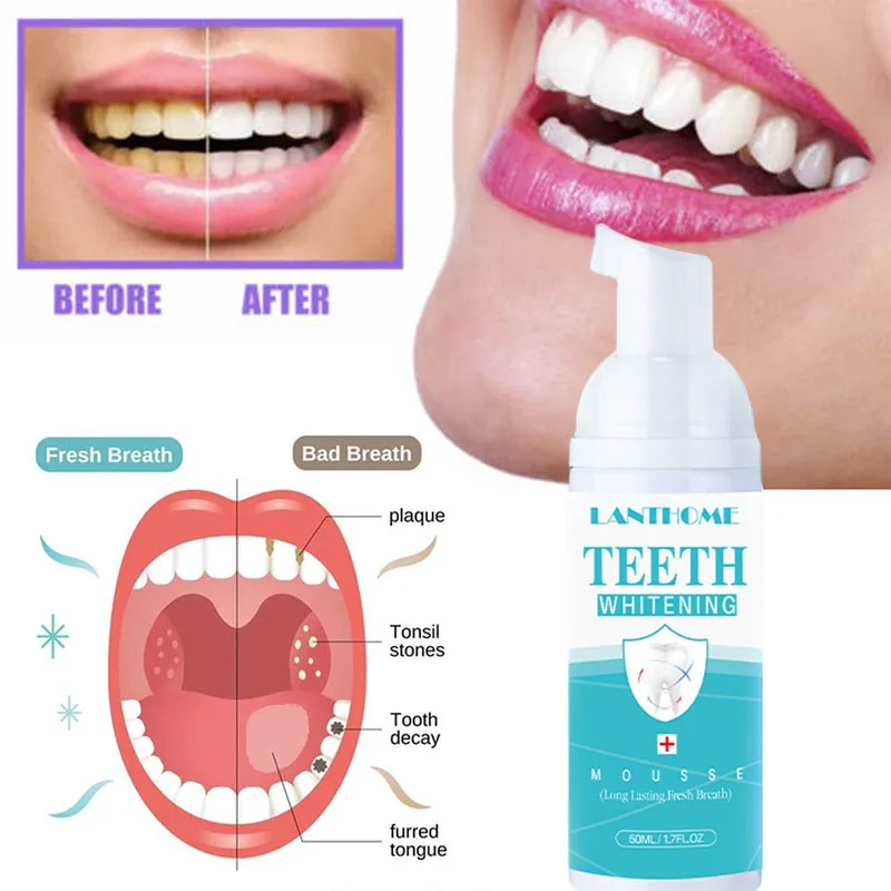 

Teeth Whitening Mousse Deep Cleaning Teeth Removes Stains Repair Bright Neutralizes Yellow Tones Dental Plaque Fresh Breath 50ML