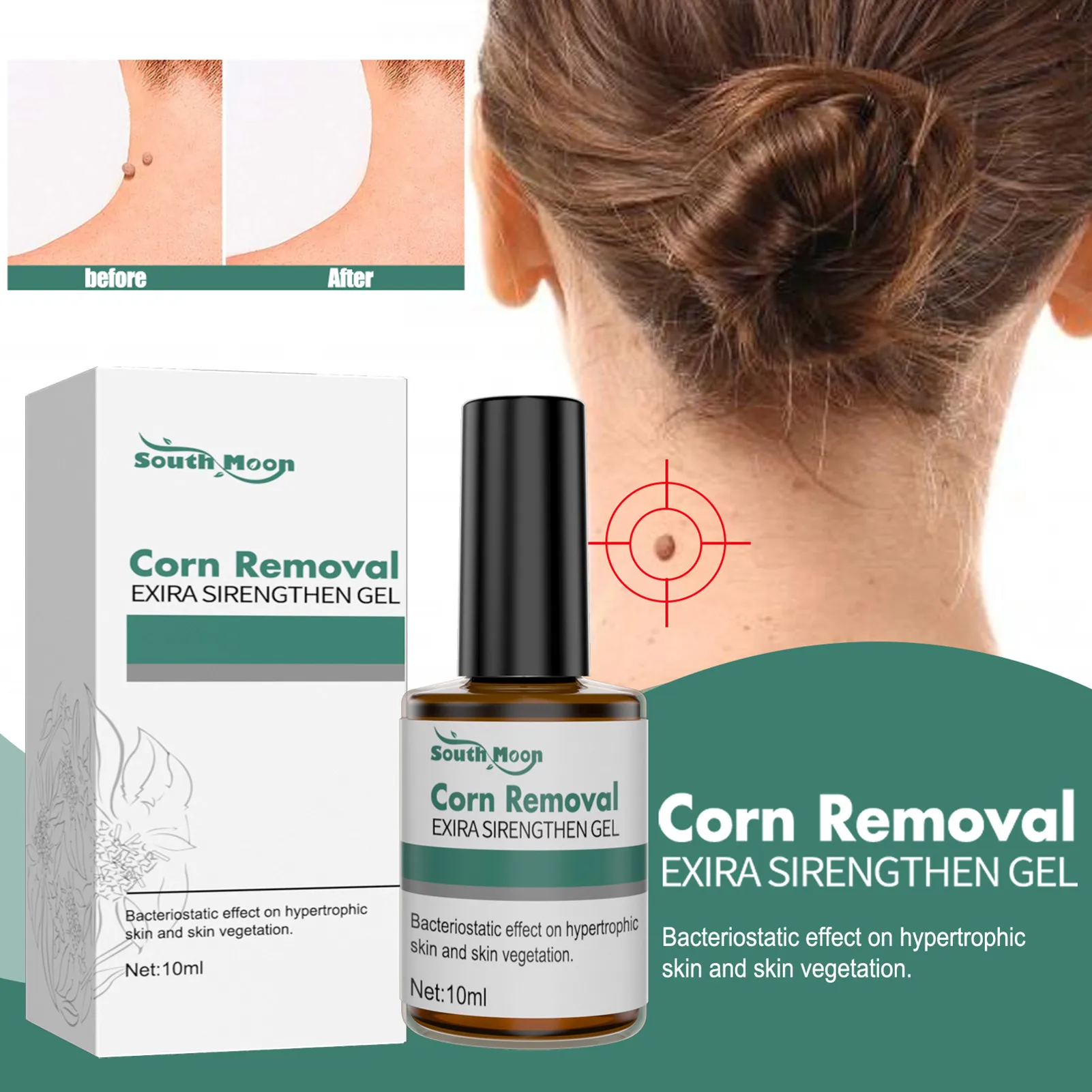 

Wart Removal Extra Strengthen Gel Foot Care Liquid Health Care Smoothing Foot Skin Essence Painless Removal Of Corns