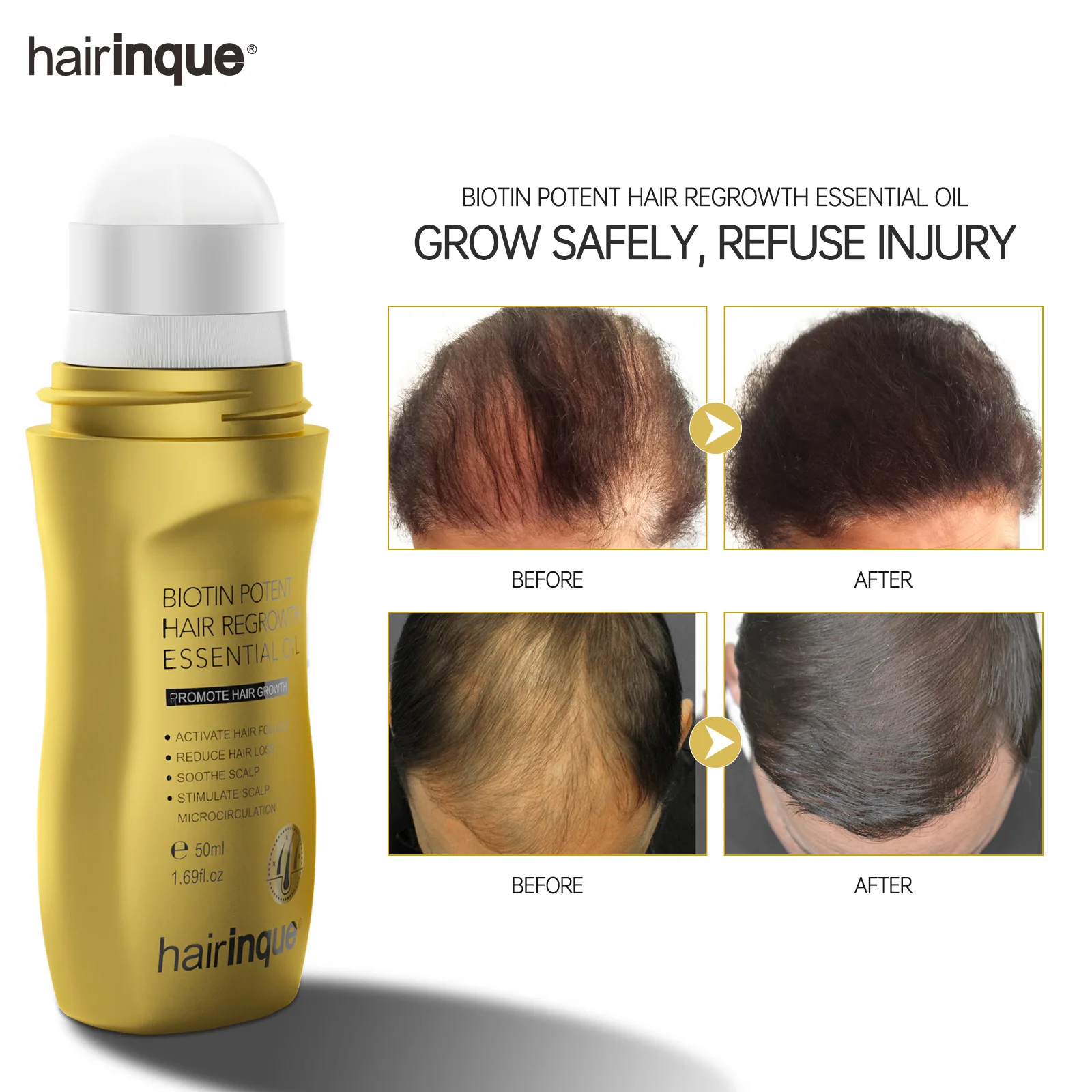 

Hairinque 50ml Vitamin B7 Fast Hair Growth Products Prevent Hair Loss Serum Scalp Treatments Growing Hair Care Oil for Men Women