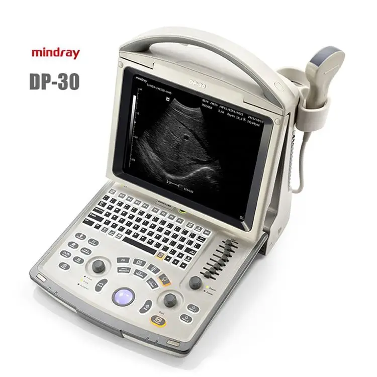 

Mindray DP-30 medical ultrasound instruments ultrasound scanner machine portable laptop ultrasounds