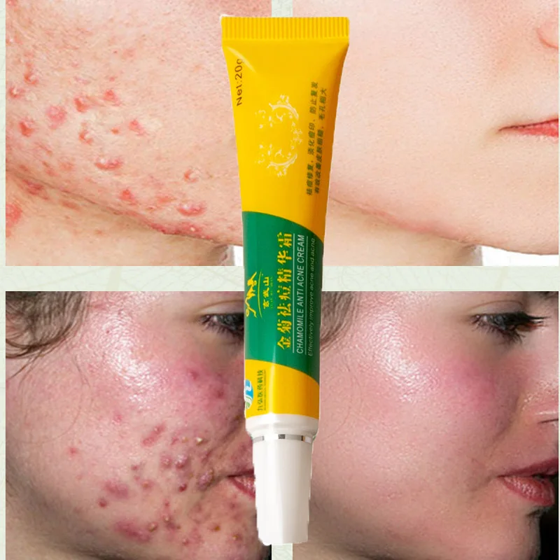 

Осветляющий крем для лица, с хризантемами