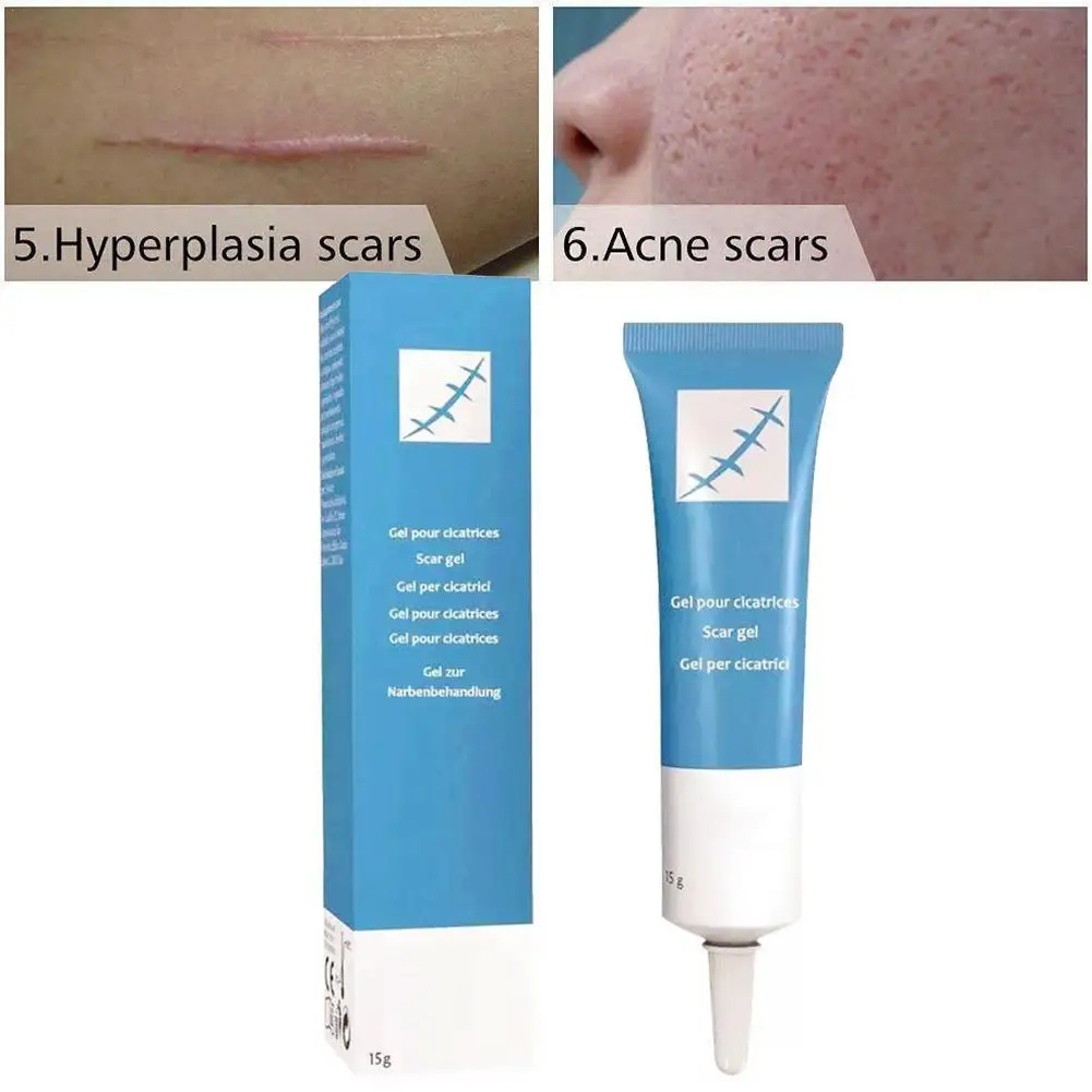 

Acne Scar Removal Cream Face Pimples Stretch Marks Gel Repairing Smoothing Moisturizing Surgical Scar Burn Body Skin Care
