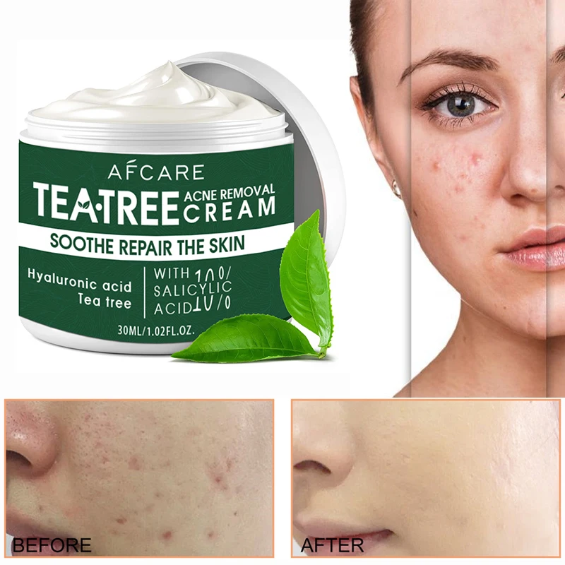 Крем для лица против прыщей с чайным деревом нелипкий прозрачный