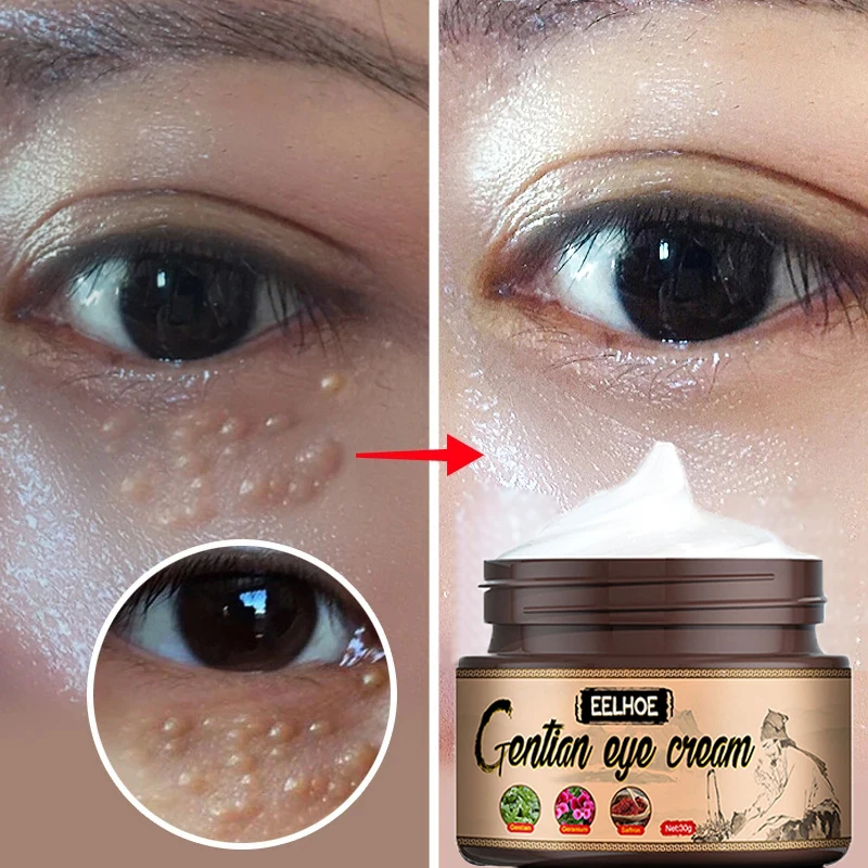 Fat Granules Remover Eyes Cream Anti Dark Circle Eye Bags Anti-Puffiness Moisturizing Firming Fade Fine Lines Eye Care Products