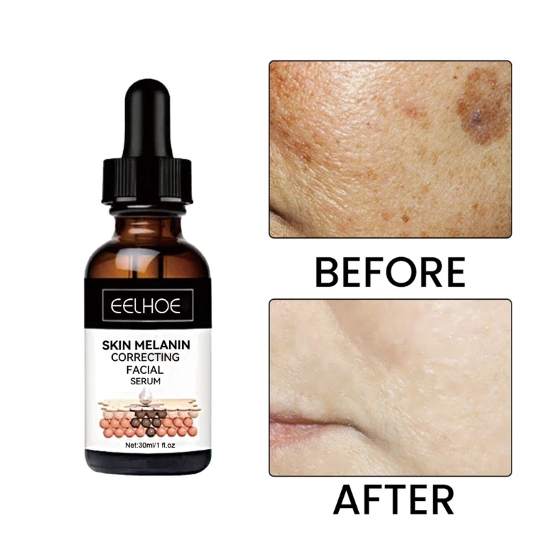 

2023 Dark Spots Remover Brightening Skin Face Oil Brighten Improve Roughness Nicotinamide Serums Whitening