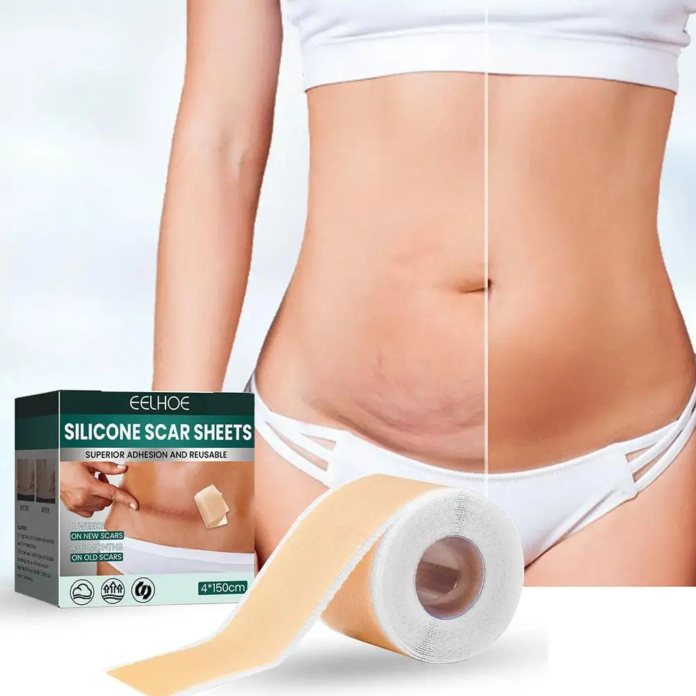 

1 рулон, силиконовые шрамы для удаления травм
