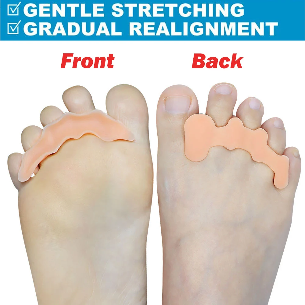 Рисунок 5 - разделители для пальцев ног для