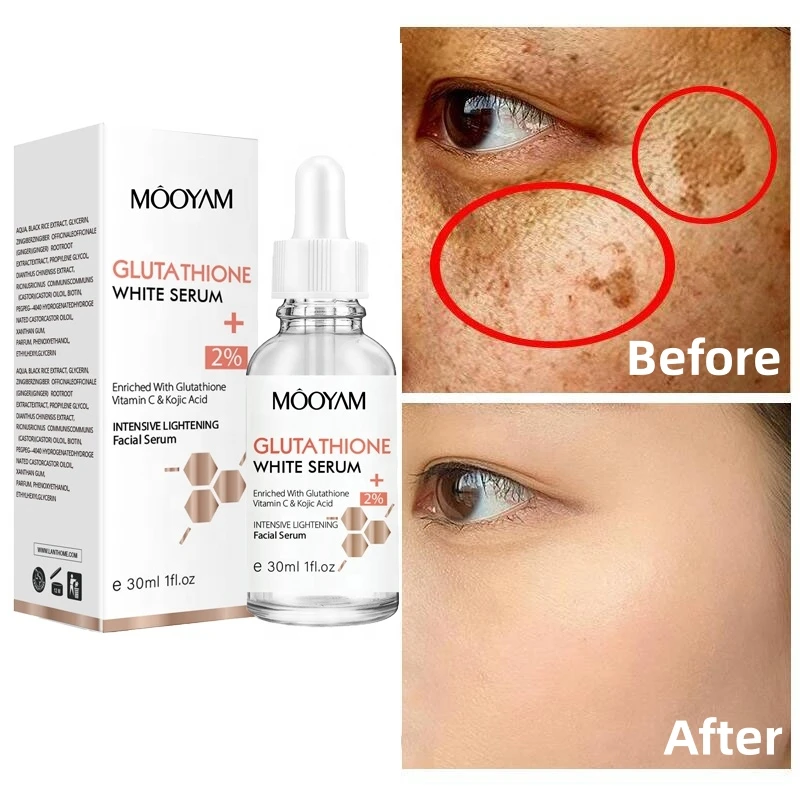 

30ml Glutathione Face Serum Vitamin C Kojic Acid Whitening Brighten Hydrating Nourishing Reduce Fine Lines Moisturizing