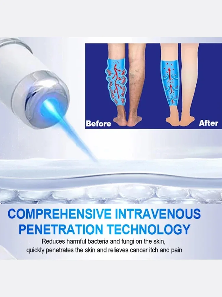 Лазерный крем Varicosse