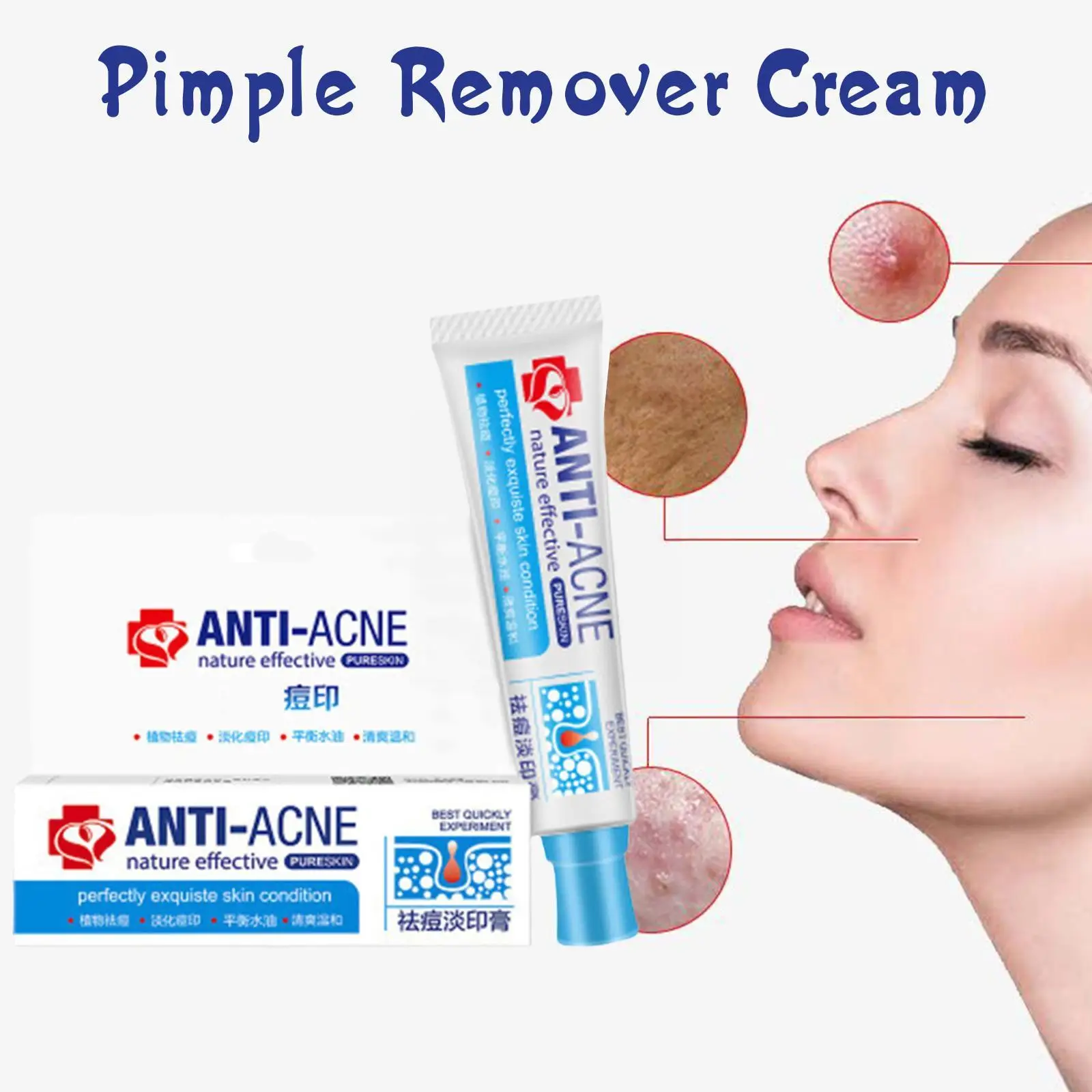 

Pimple Remover Acne Cream Herbal Anti Effective Acne Pores Cream Medicine Chinese Gel Shrink Traditional Treatment Removal C6K0