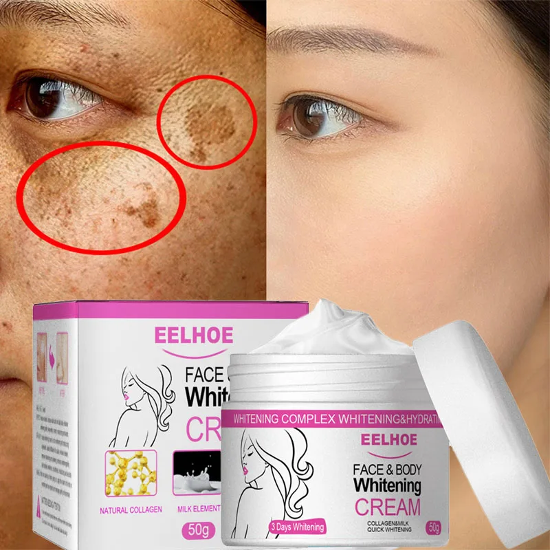 Arbutin Facial Whitening Freckles Cream Remove Melasma Dark Spot Lighten Brighten Melanin Retinol Anti Aging Fade Face Wrinkles