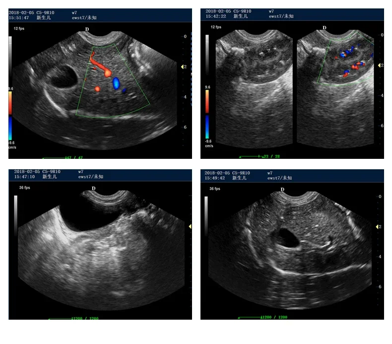 Портативный Ультразвуковой/ветеринарный аппарат для животных портативный