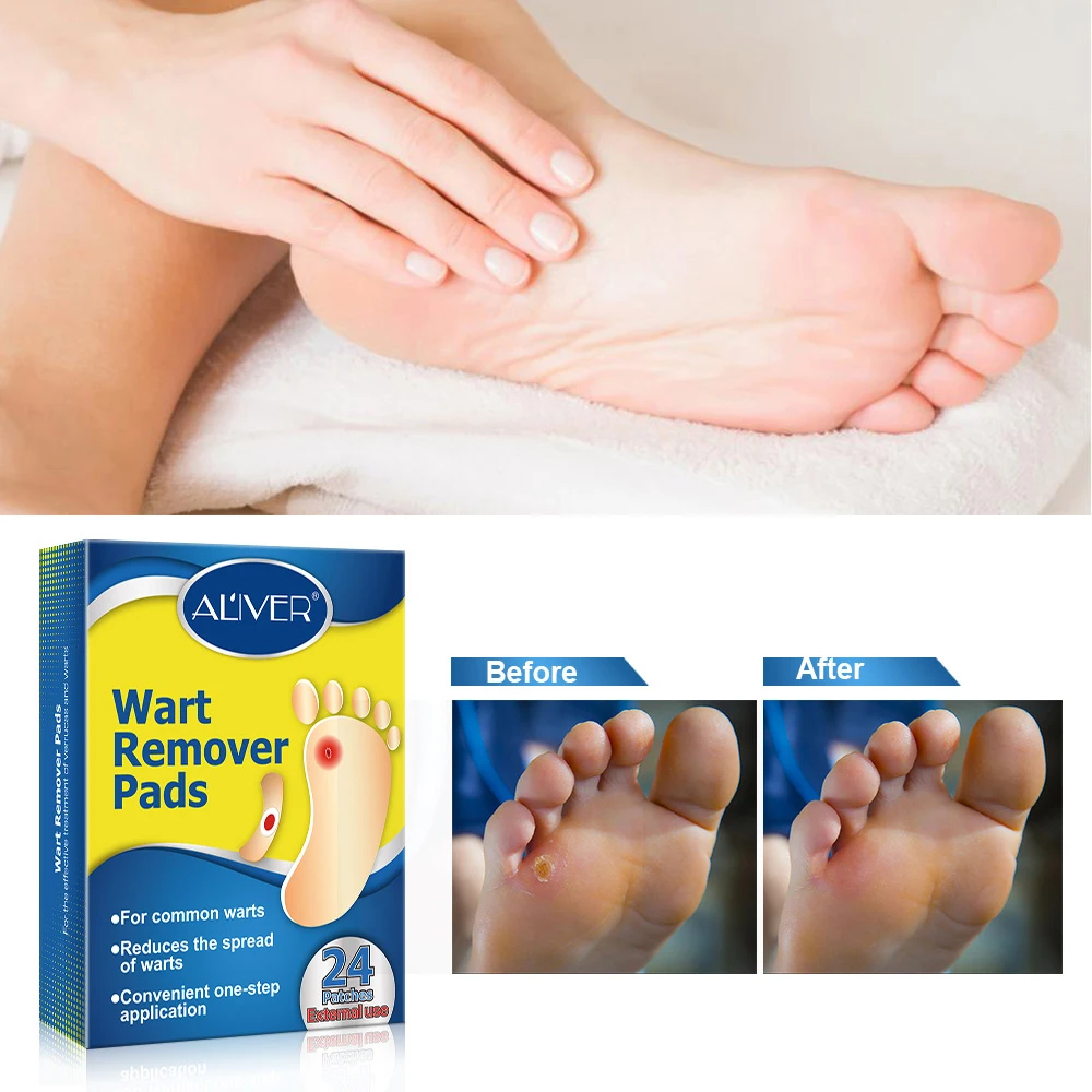 

24pcs Painless Foot Care Foot Warts Thorn Plaster Patch Corn Sticker Feet Callus Removal Tool Soften Skin Cutin Foot Care