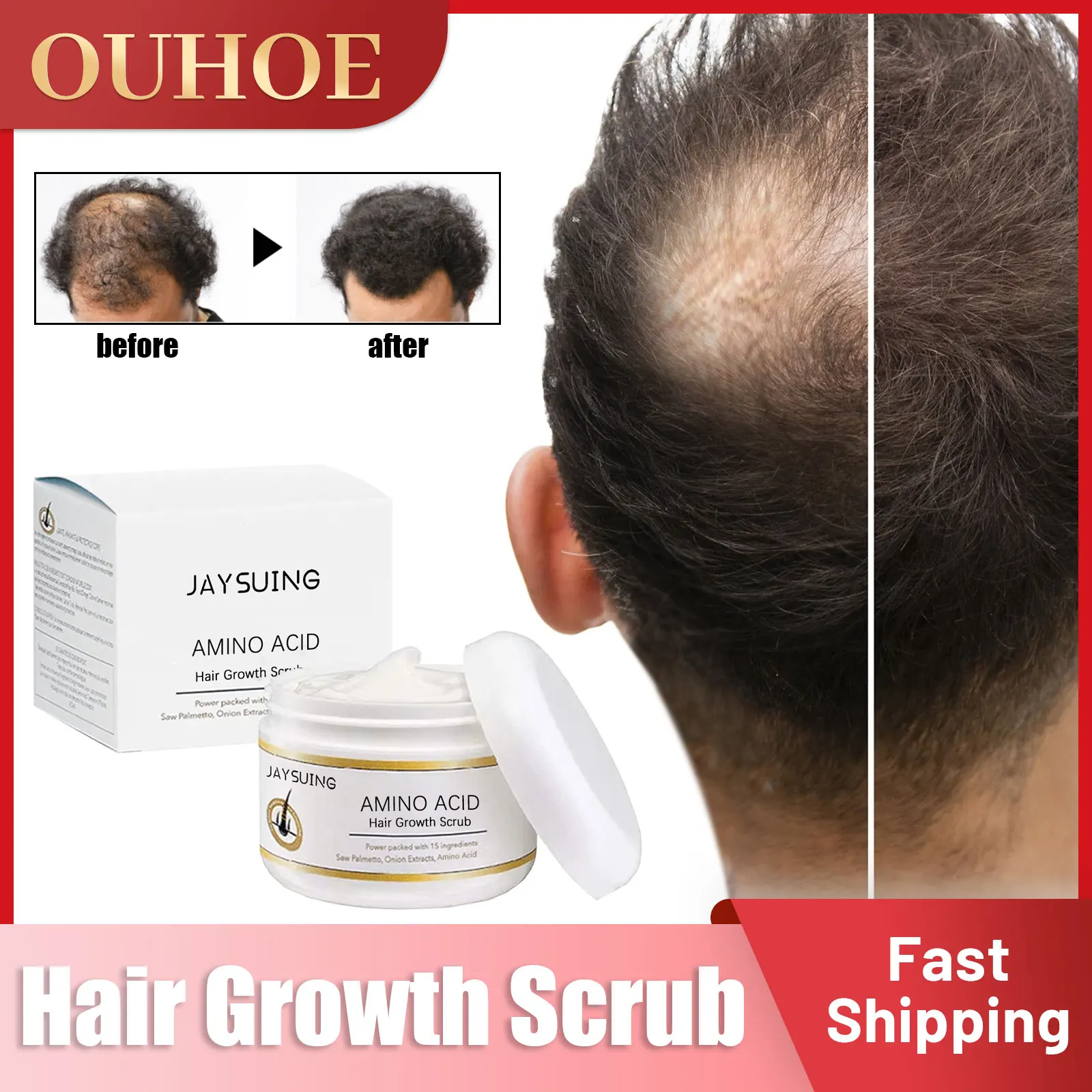 

Hair Growth Scrub Grow Nourishing Repair Hair Roots Cleaning Antipruritic Refreshing Scalp Treatment Alopecia Dense Hair Scrub