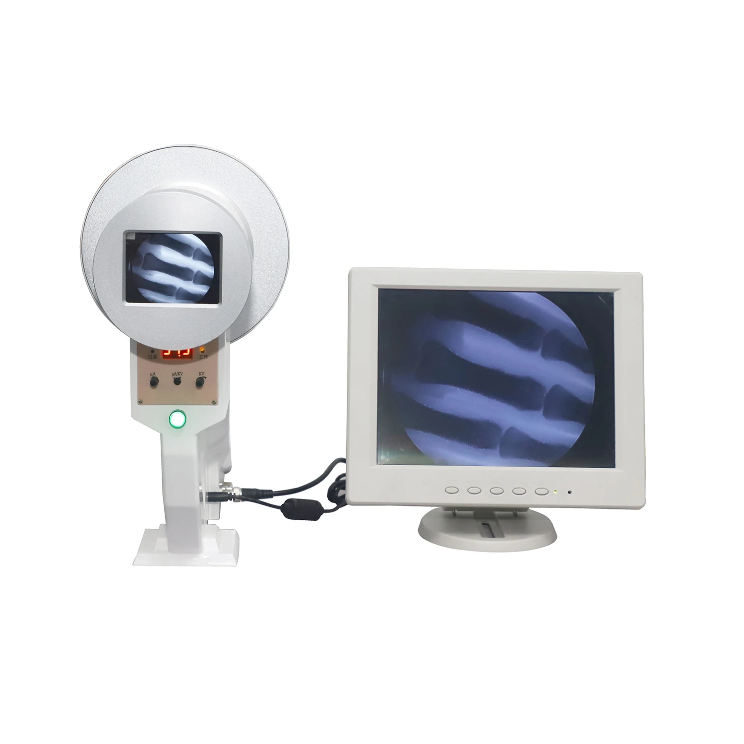 

portable Veterinary Portable X-ray Machine Made in China Fluoroscopy System Hospital Fluoroscopy