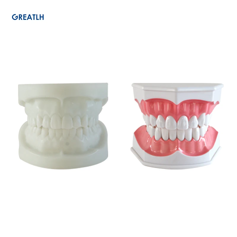 

Dental Implant Demonstration Model Teeth Study Teach Model Communication Transparent
