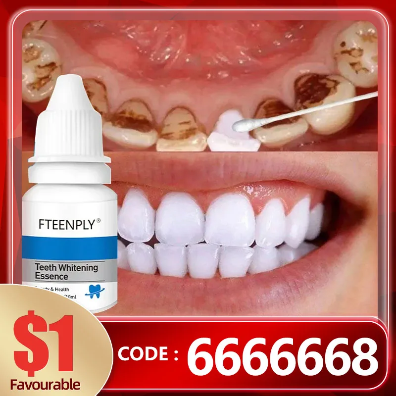 

Эссенция для отбеливания зубов, сыворотка для удаления пятен от зубов, желтого цвета, свежее дыхание, гигиена полости рта, стоматологические инструменты