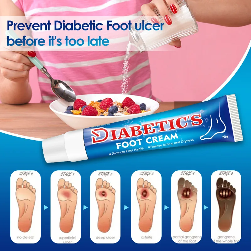 Крем для ног диабетиков зуд мазь ухода за ногами улучшает сияние кожи