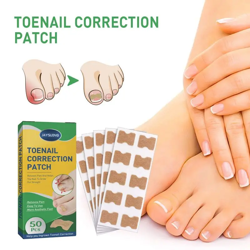 

50 Sticks Toenail Groove Correction Stickers Repair Ingrown Toenails