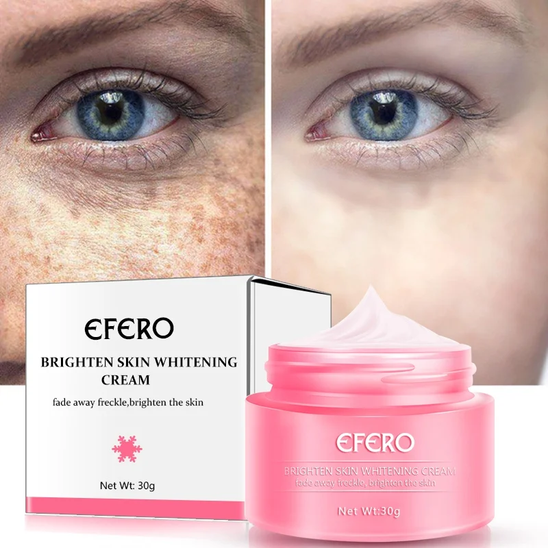 

30g Remove Freckles Cream Reduces Age Spots Fade Dark Spots Skin Whitening Cream Treatment Stain Face Cream