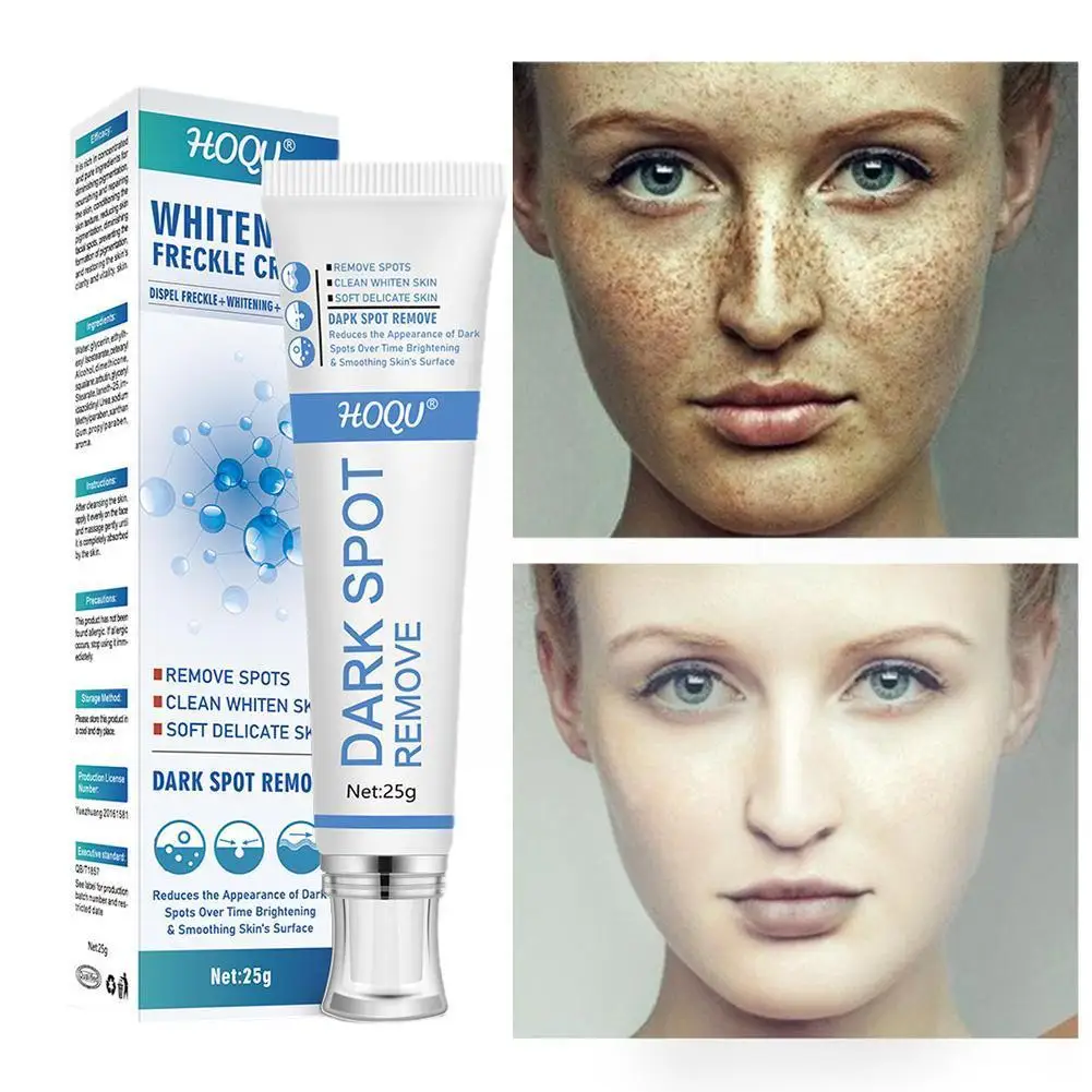

Whitening freckle cream Effectively Removes Dark Spots Care Sun Age Spots Chloasma Spots Freckles Whitening Skin Brightenin
