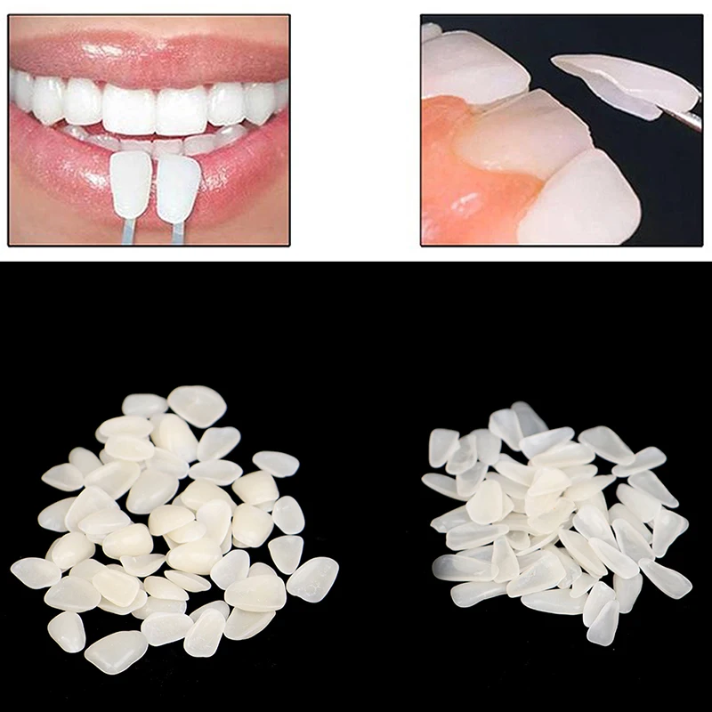 

60PC Dental Film(No Glue) Dental Ultra-Thin Whitening Veneers Resin Porcelain Materials Temporary Teeth Upper Anterior Whitening