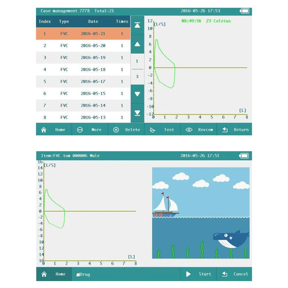 Цифровой спирометр Contec SP100 портативный тестер функций легких легкое устройство