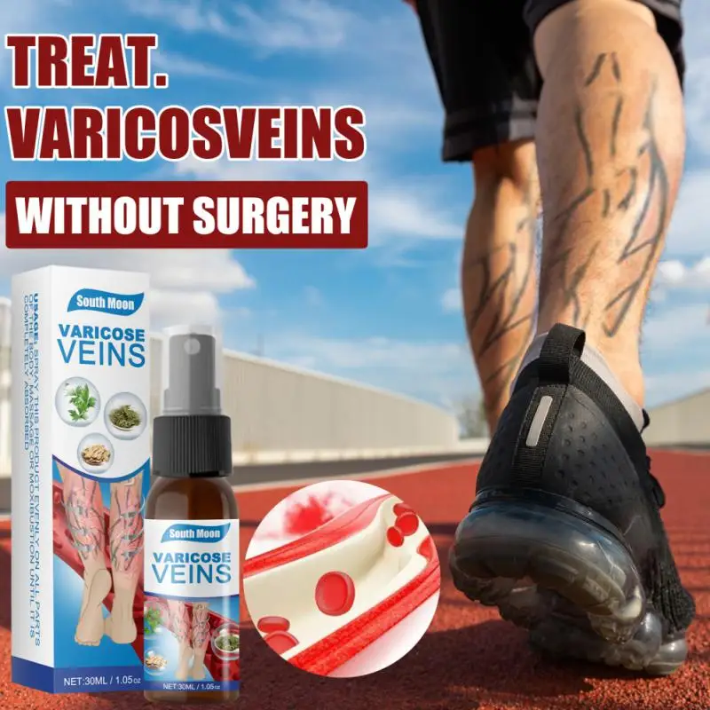 

Varicose Vein Spray Natural Herb Veins Soothing Essential Oil Spray Spider Vein Edema Neuralgia Earthworm Leg Cure