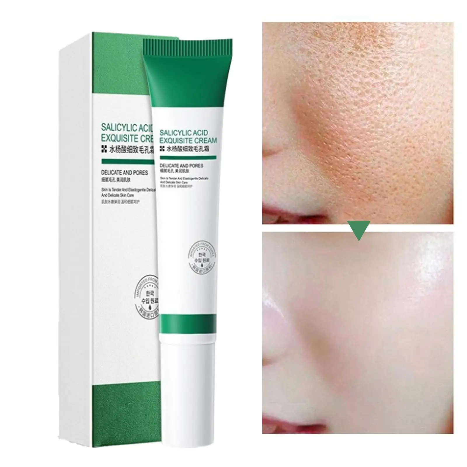 

20ml Salicylic Acid Refining Cream Improve Pimple Blackhead Treatment Shrinking Pores Whitening Anti-Acne Face Gel Skin Care