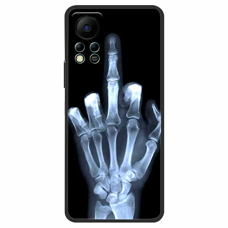 for infinix hot 11s nfc case x6812b shockproof soft silicone tpu back cover for infinix hot 11s nfc phone cases hot11s nfc cute free global shipping