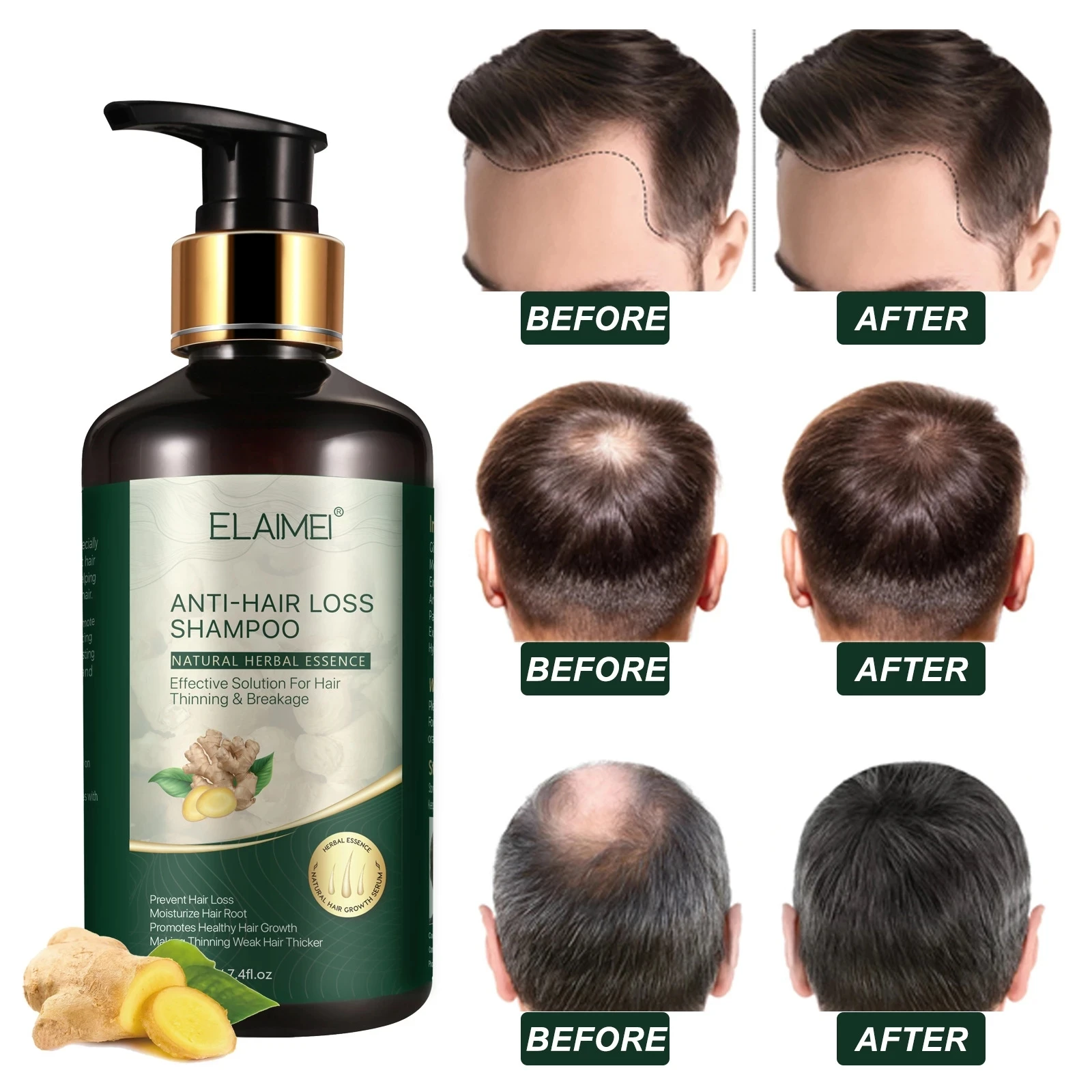 

220ml Hair Growth Shampoo Anti Hair Loss Shampoo Regrowth Chinese Herbal Ginger Hair Repair Prevent Product Hair Loss Treatment