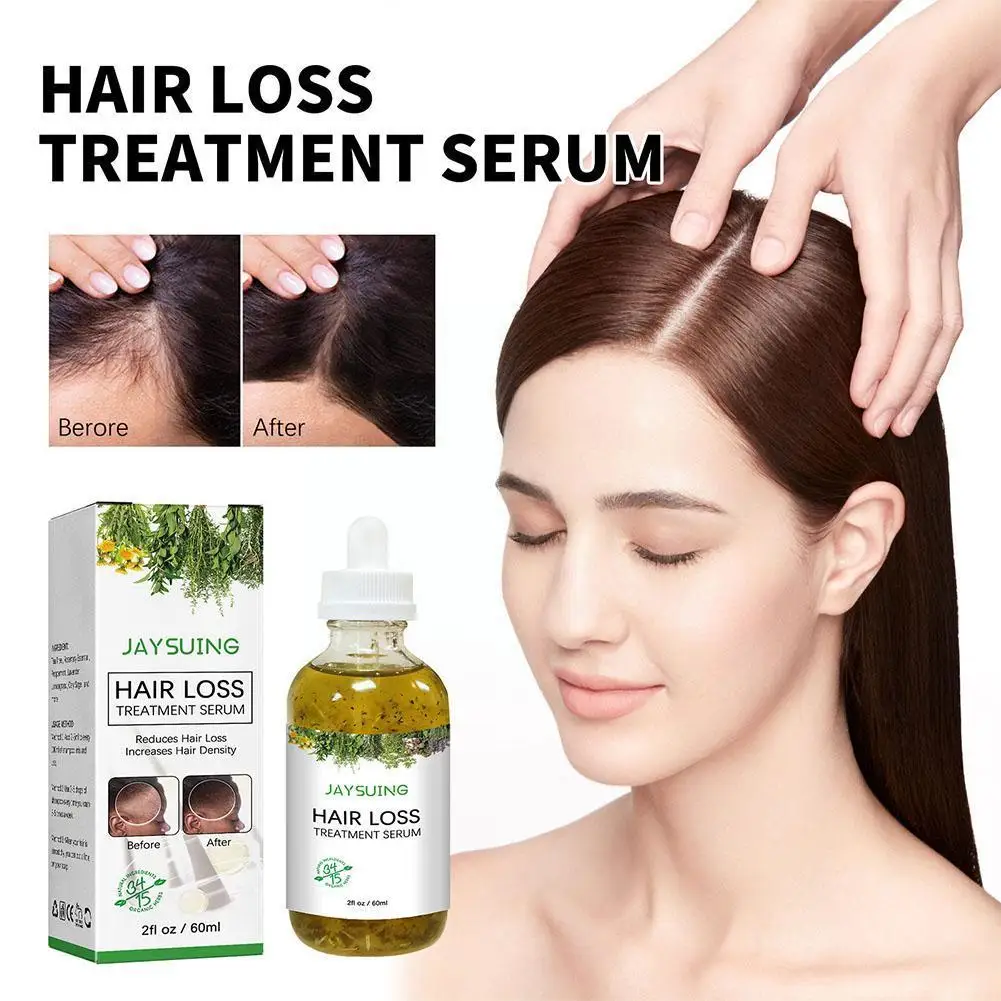 

Hair Loss Treatment Shampoo Anti-itch Anti Dandruff Growth Control Thicker Scalp Oil Fast Oil Regrowth Hair Essence Serum R T5Q4