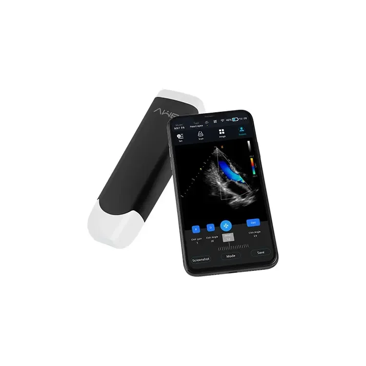 Рисунок 3 - Ультразвуковое, оптическое