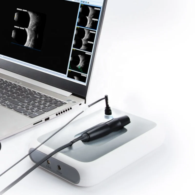 Офтальмологические ультразвуковые A/ B Pachymeter Scan портативный офтальмологический