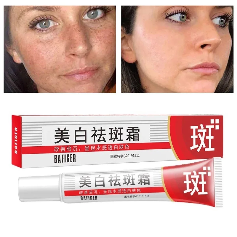

Whitening Freckle Cream Remove Melasma Cream Remove Dark Spots Melanin Melasma Remover Brighten Skin Anti-Aging Skin Care