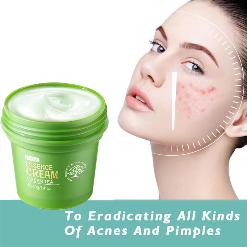 

Green Tea Cream For Face Acne Tratamiento Moisturizer Bleaching Anti Ride Visage Facial Crema Quita Manchas De La Cara Skin Care