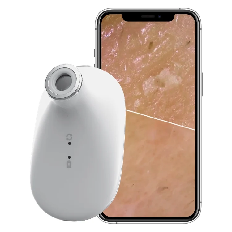 

Ручной аппарат для анализа кожи лица, анализатор кожи, технология AI, анализатор кожи