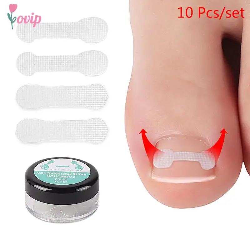 

10pcs/box Ingrown Toe Nail Correction Sticker Patch Paronychia Correction File Acronyx Wire Corrector Foot Care Treatment